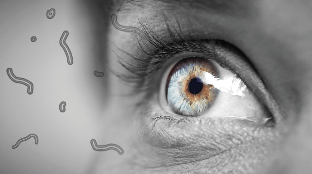 Floaters in your Eyes: What are They, and Should You be Concerned?