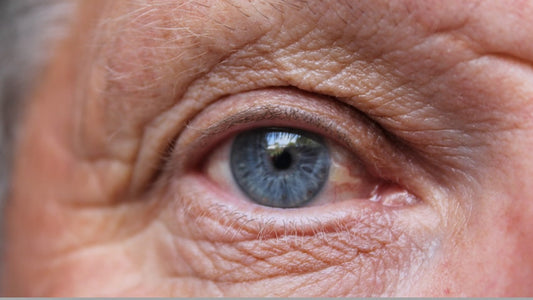 Protecting Your Eyes from Age-Related Macular Degeneration: Don't Let Your Vision Go with the Ageing Process!